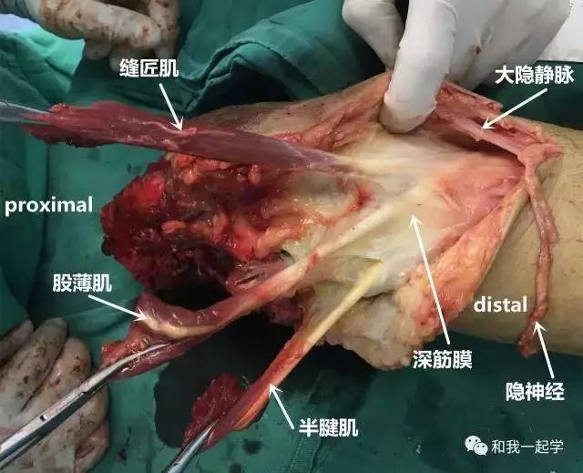 骨哥阅片课堂:膝关节鹅足的实战解剖