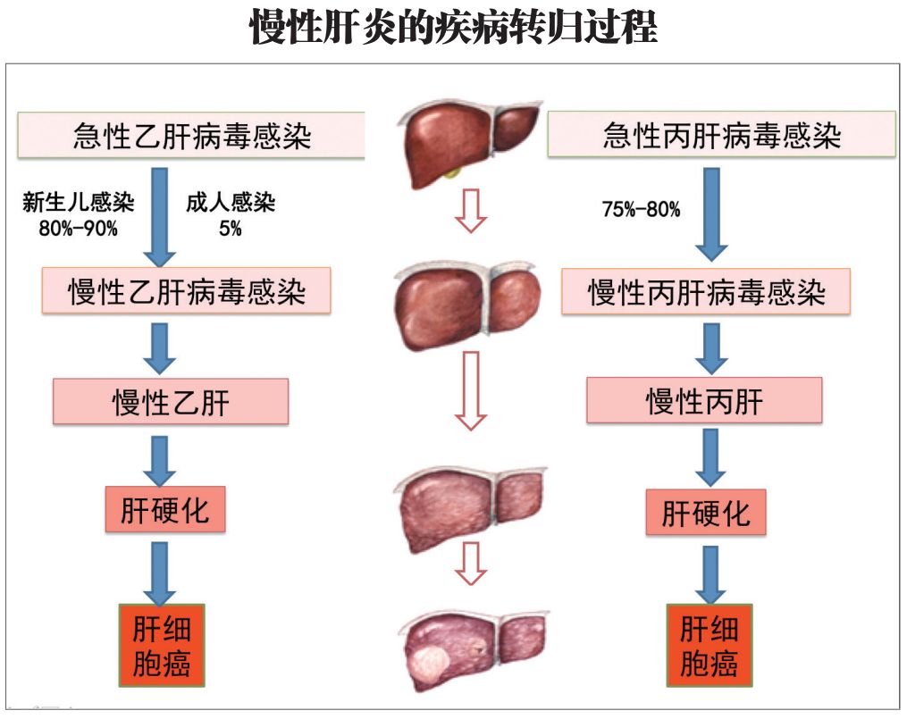 人体从感染肝炎病毒到第一次出现急性肝炎症状有一段时间的潜伏期.