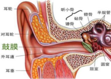 鼓膜穿孔了:咋办?