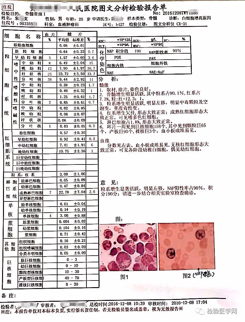 脾大或不大,肿瘤都在那儿