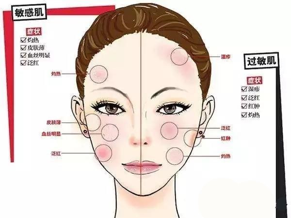 敏感性皮肤如何挑选护肤品_时尚女人_南阳新