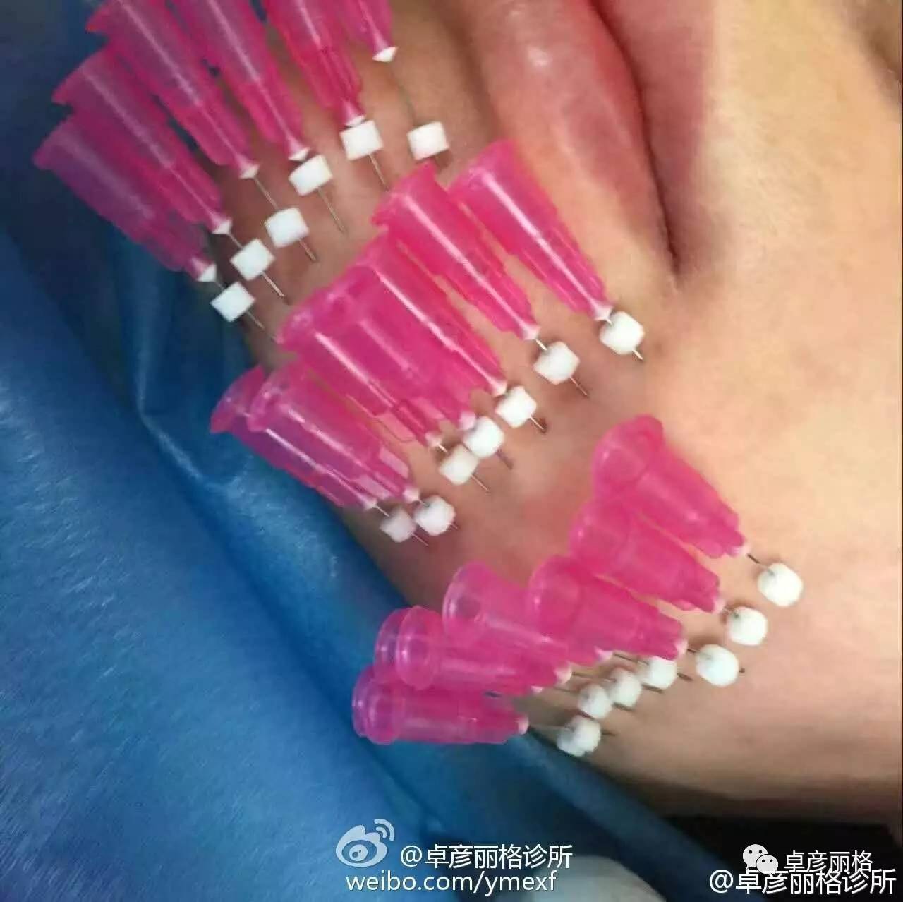 线雕---埋的是线,锁住的是年龄