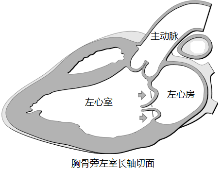 有多种原因,瓣叶,瓣环,腱索,乳头肌及左心室壁的异常都可导致,其中瓣