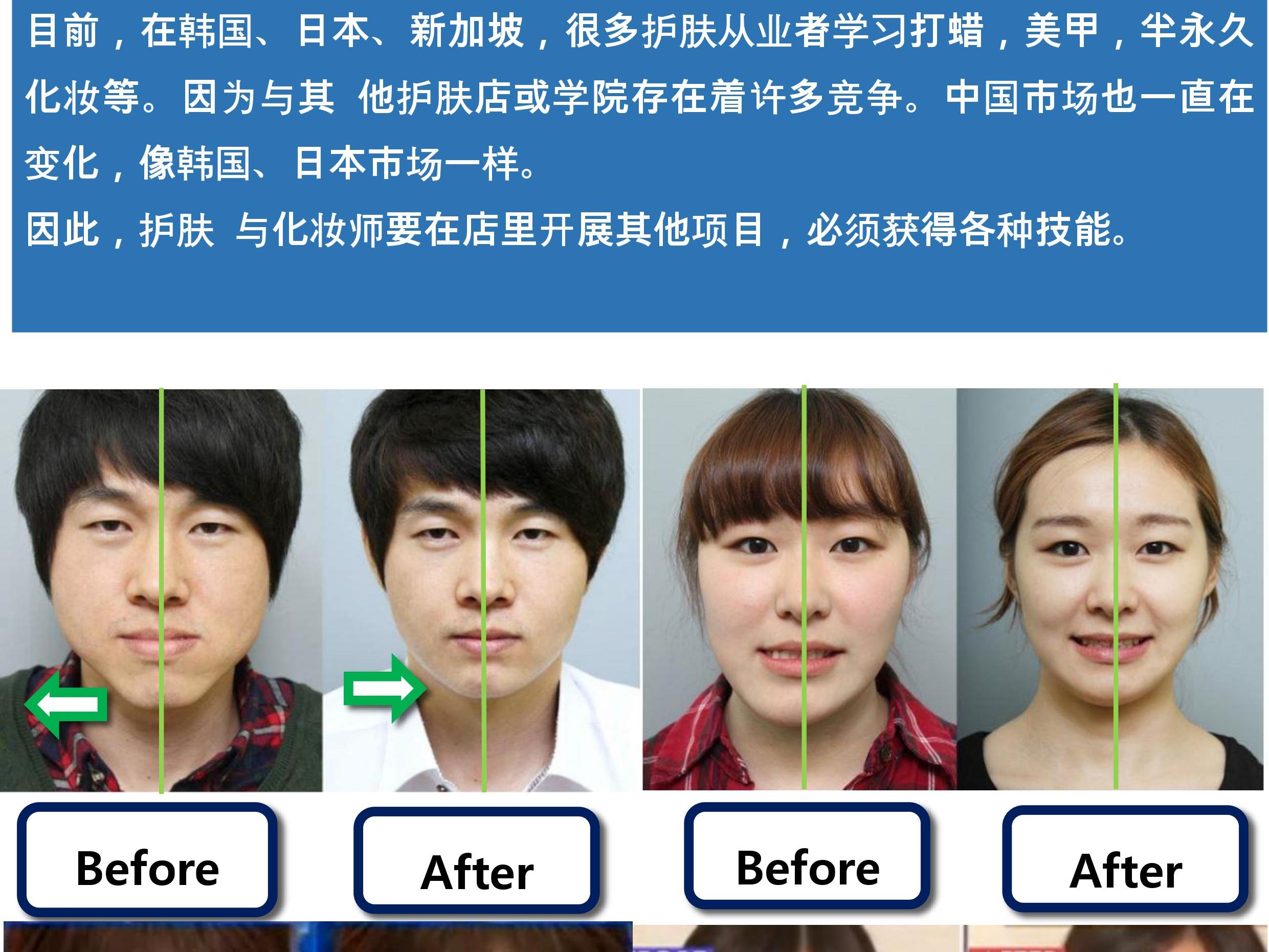 改脸型|颧骨突出、颧弓外扩、下颌骨宽，脸宽？瘦脸修容方法揭秘