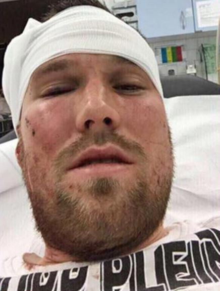 世界杯冠军因街头飙架遭开除 后脑被打得血肉
