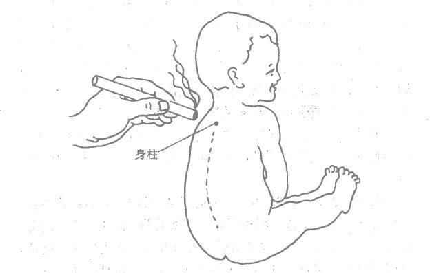 儿童疾病更适合艾灸调理, 无副作用还强身健体! .艾灸养生