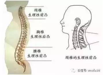 脊椎s型弯曲,弓背,就来练这3个瑜伽体式吧!