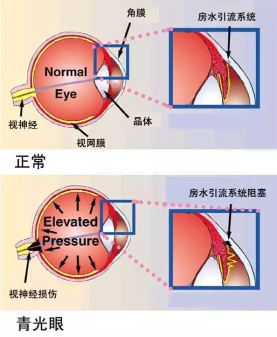 睡前关灯追剧,女大学生差点"失明"……吓得我扔掉了