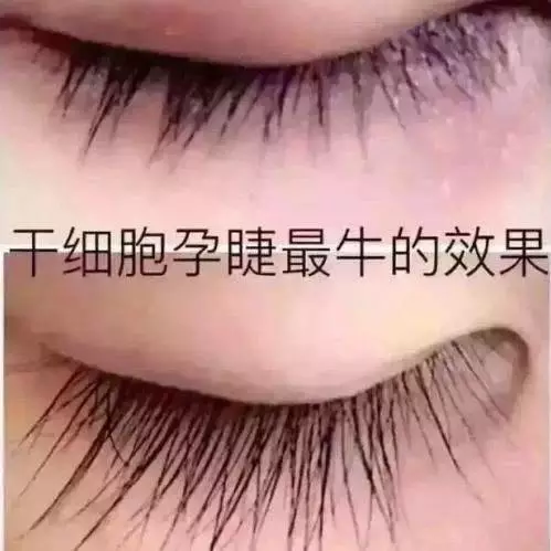 孕睫什么原理_倒睫是什么样子图片(2)