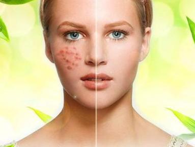 为什么皮肤老是过敏, 过敏的根源是什么?姗俐