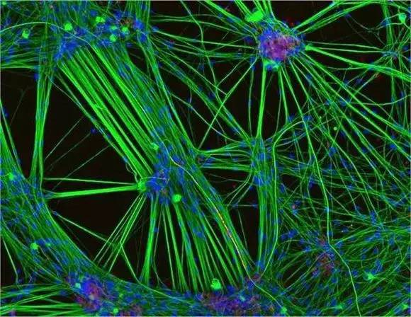 显微镜下 错综复杂的诱导神经细胞