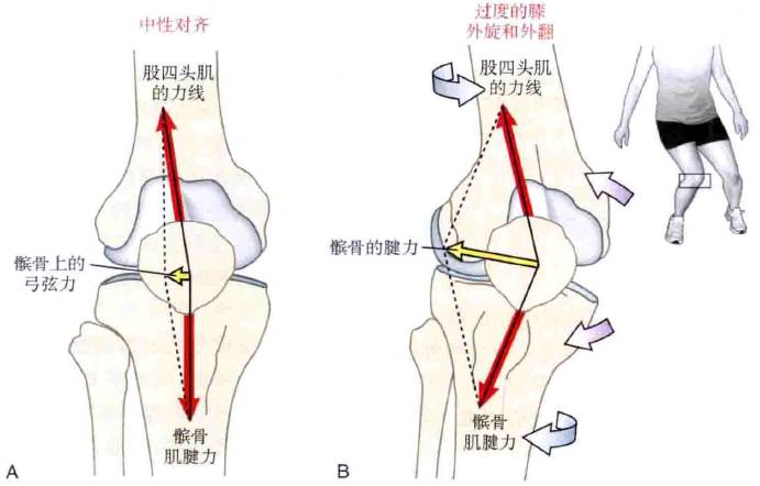 【专业分享】膝膝相关——髌骨的正确移动姿势