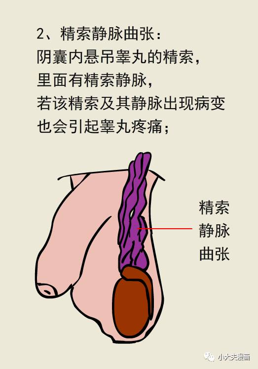 蛋疼(睾丸炎)这件事,没有比这个科普更简单易懂了!