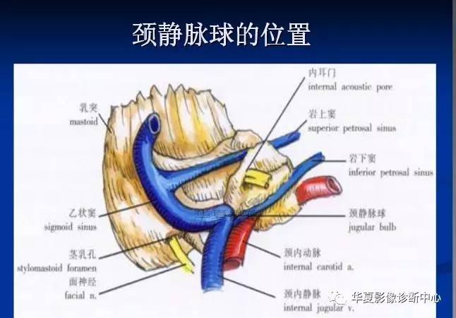 颈静脉球的变异与疾病诊断!