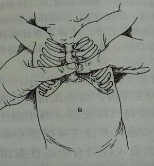 (图1:双指按压法,用于新生儿及小婴儿)新生儿及小婴儿:可一手拖住