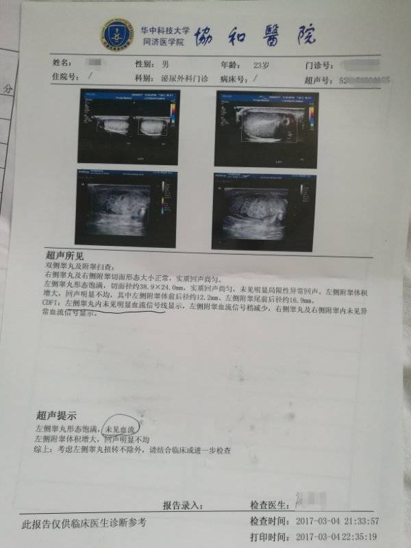 8时许左侧阴囊疼痛,前来武汉协和医院西院泌尿外科就诊,急诊彩超显示