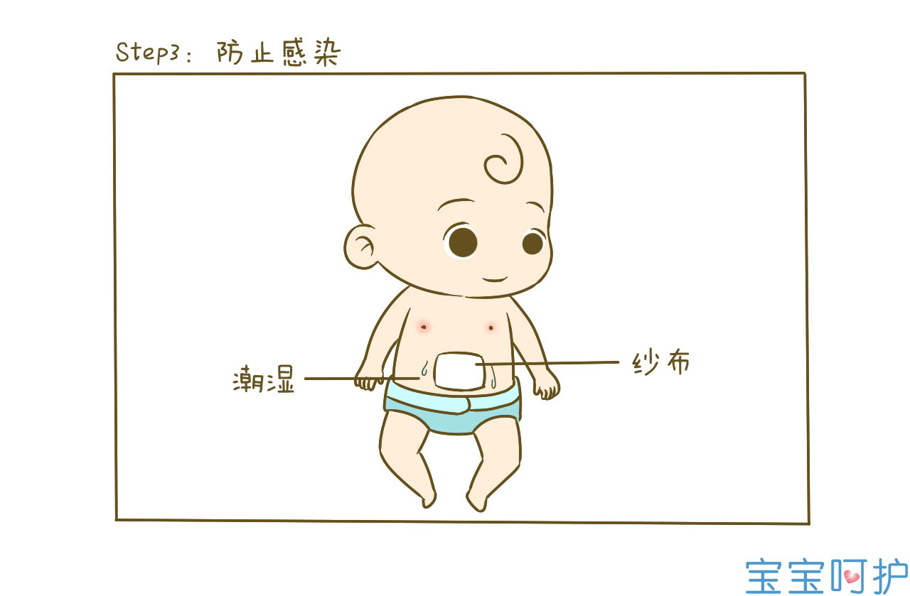 新生儿脐部正确护理, 脐带未脱落和脱落后的不同护理方法