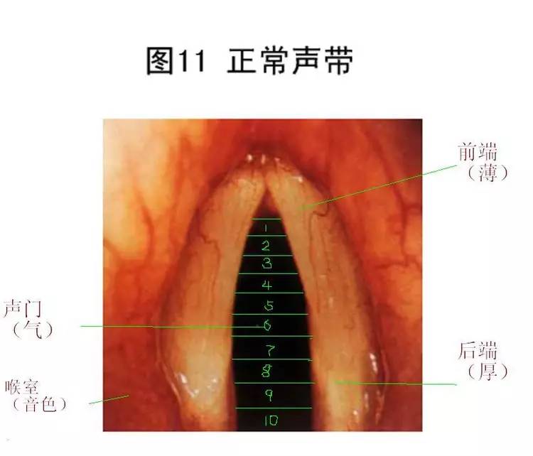 迪玛希"失声",想要好嗓子,请拒绝甜食