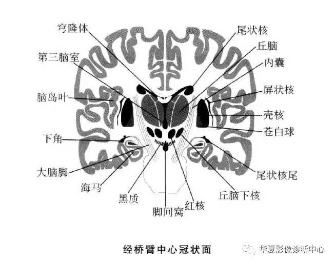 【影像基础】值得收藏的基底节及周围区域解剖详图