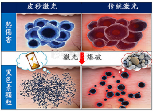 皮秒激光的原理和作用_皮秒激光切割玻璃的原理和工艺研究(3)