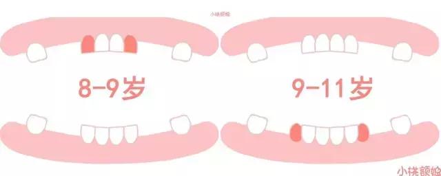 英 吴礼安该图出自《实用儿童口腔医学》2016年第1版本乳牙总数=月龄