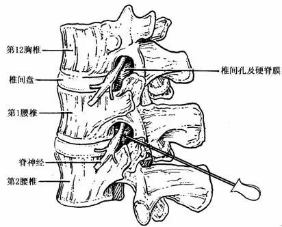 3分钟深度了解腰椎管狭窄图文详解