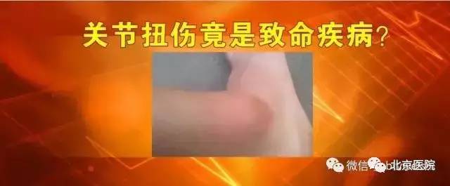 养生堂》播出北京医院汪芳教授:警惕要命的腿肿