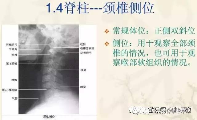 史上最实用全身各部位各体位x线片摄影要点