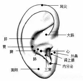 耳后止痛贴是什么原理_钱是万能止痛贴图片(3)