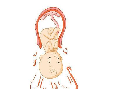 破膜后宫缩加强,胎头下降加速,胎头对宫颈压力增加又反射性使前列腺素