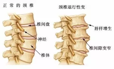 成语什么缩颈_成语故事简笔画(2)