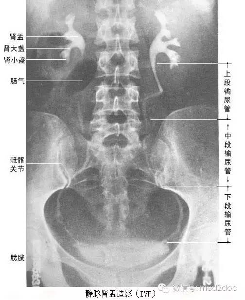 17张人体解剖x线影像图解(值得收藏)