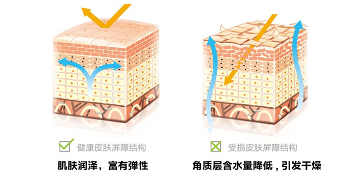 修复皮肤的屏障功能意味着恢复皮肤表皮的正常结构和成分组成.