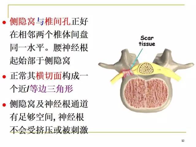 腰椎间孔的解剖与临床