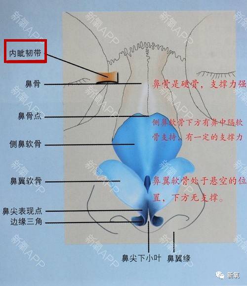 先看一个图吧,与我们眼角位置息息相关的有一个叫做内眦韧带的玩意儿.