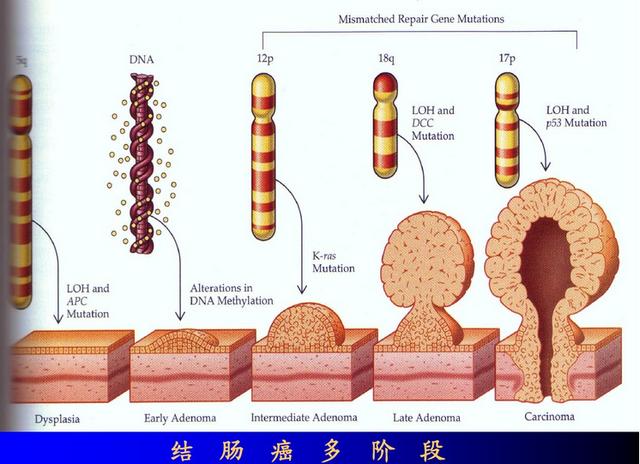 物理因素,生物因素和遗传因素;多阶段指,肿瘤的形成和发展过程有激发