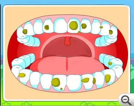 1,"斑块"超级粘生物膜在你的牙齿表面 口腔是一个充满各种微生物的