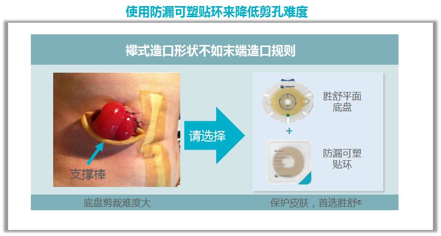 第二届康乐保护理高峰论坛前沿分享Ⅱ——临时性回肠造口护理特点及