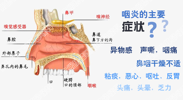 饮食过咸,会引起咽炎?咽炎吃什么食物