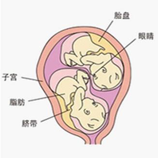 神奇的过程,一模一样的双胞胎是这样产生的