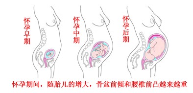 产后一个月腰疼怎么办