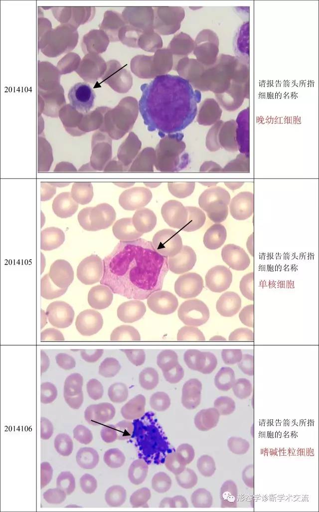 卫生部血细胞形态学室间质量评价及答案(2014年度)