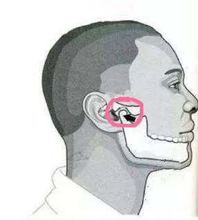 (正经脸) 告诉你,这应该是 颞下颌关节紊乱综合征.