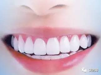 我们都想拥有一口非常漂亮,笑起来非常洁白的牙齿.