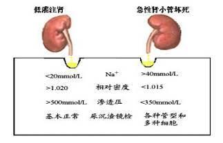 李俪:肾病综合症会有哪些症状