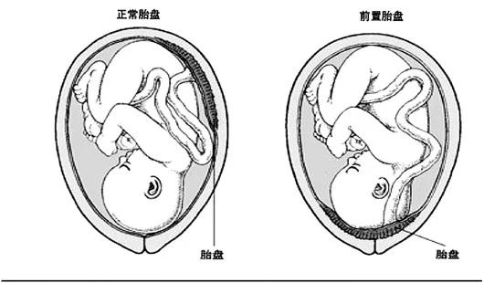 成语流血浮什么_成语故事图片(3)