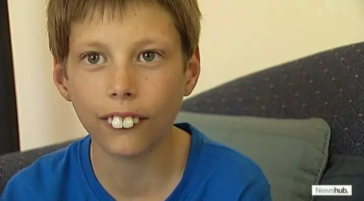 因为龅牙被欺负,现在这个新西兰小男孩终于可以微笑了