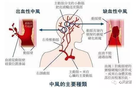 世界人口死亡原因_...旧中国在较长的历史时期中,由于战争 疫病等原因,死亡率(3)