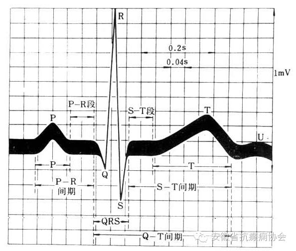 心电图两条纵线间(1mm)表示 0.
