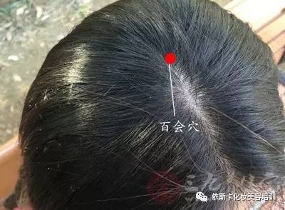 刮痧出现黑紫说明什么 如何正确刮痧